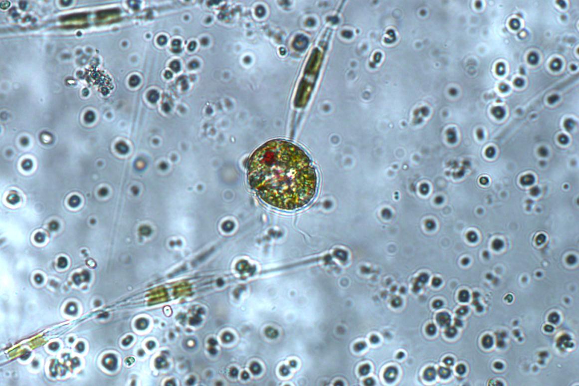 Harmful Algae microscope image