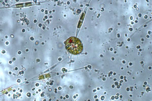 Harmful Algae microscope image